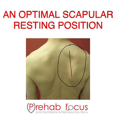 metal brackets pulled from left scapula|normal resting position of the scapula.